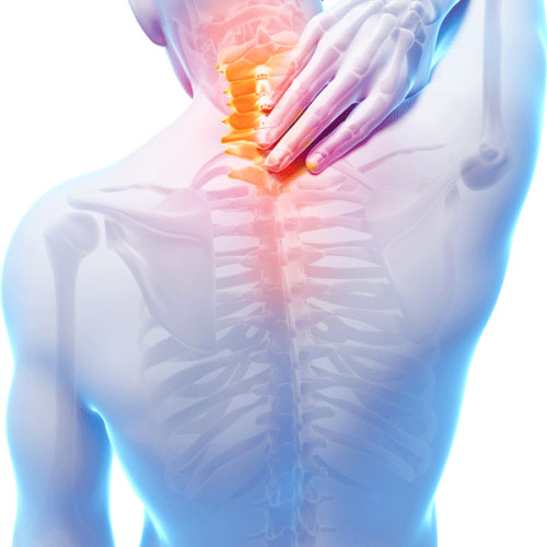 kisspng-neck-pain-myofascial-pain-syndrome-muscle-pain-chr-5b3f2860219770.8046711815308657601376-500x500