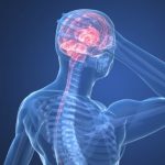 Cervicogenic-headaches-01-150x150
