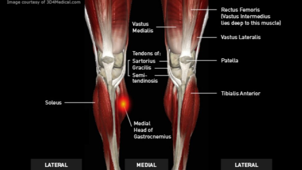 Legs_TennisLeg_large_Calf-1-1024x576