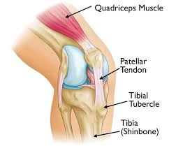 Osgood-schlatter-diagram