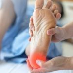 Plantar-Fasciopathy-150x150