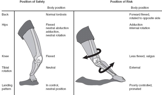 acl-prehabilitation-article