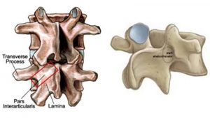 lower-back-stress-five-dock-300x169
