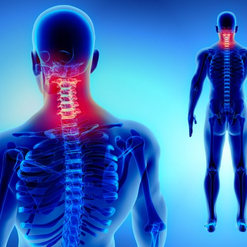 skeleton-neck-facebook-e1572322180705-500x500